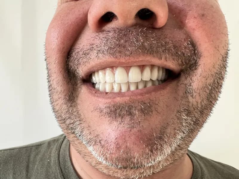 Cliente Ornare sorrindo